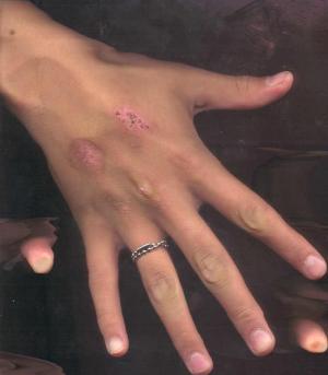 handugly.jpg